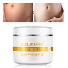 CAIZILAN Precious Skin Care Body Cream Stretch Marks Remover And Scar
