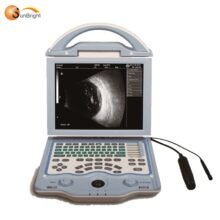 Ophthalmic Ultrasound a b Scan Medical Equipment for biometry eye test in ophthalmology