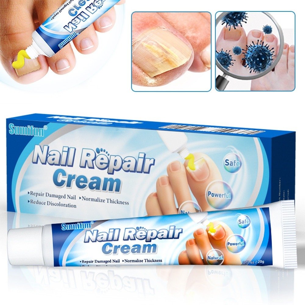 5pcs Nail Fungal Removal Ointment Toenail Whitening Nail Repair Treatment  Cream Anti Infection Paronychia Onychomycosis A655 | Fruugo KR
