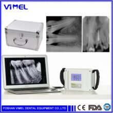 Good Touch Screen Dental X Ray Unit/High Frequency Portable dental X Ray machine/Dental imaging system
