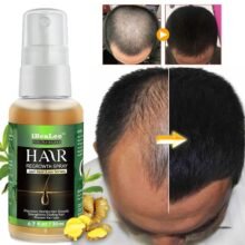 Hair Care Hair Growth Essential Oils Essence Original Authentic 100% Hair Loss Liquid Health