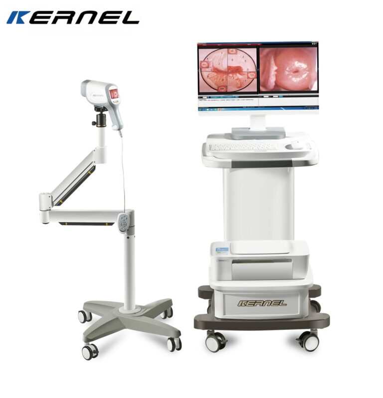 High Quality Digital Portable Video Vagina Colposcope Dumping Design Camera Imaging System