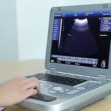 echo medical Portable Color Ultrasonic imaging Device 15 inch 3D Ultrasound Scanner Diagnostic System