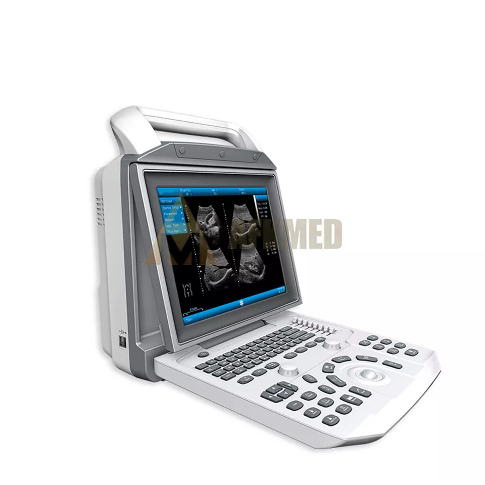 Black white hospital medical ultrasound handheld ultrasound scanner with PW function