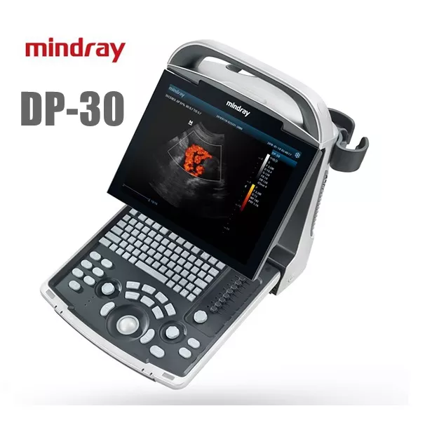Mindray DP-30 Ultrasound System