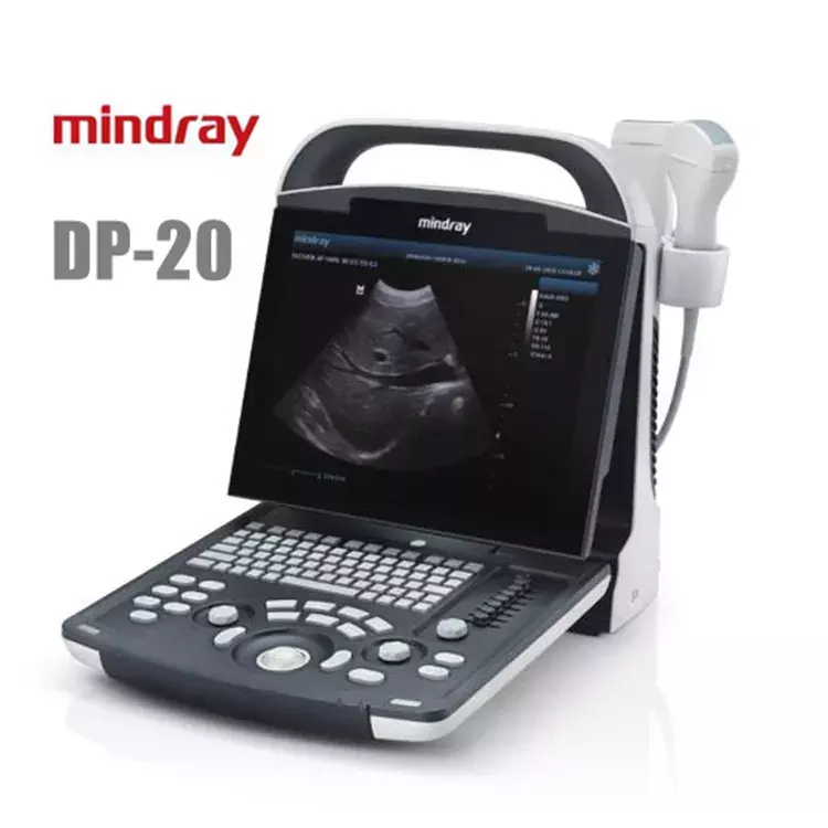 Mindray DP-20 Ultrasound Scanner