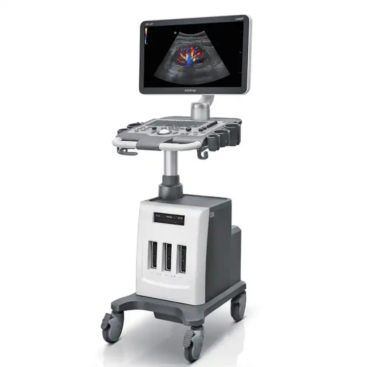 mindray DC- 30 Diagnostic Ultrasound System